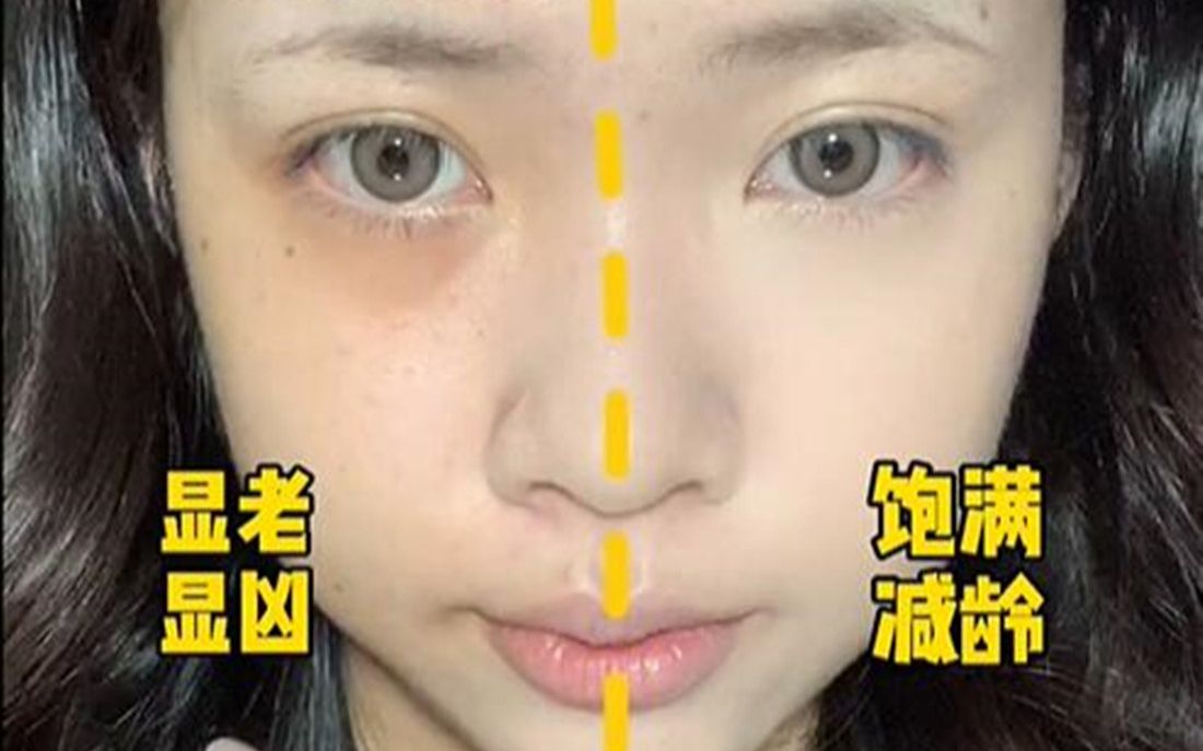 保姆级黑眼圈泪沟消失术!哔哩哔哩bilibili