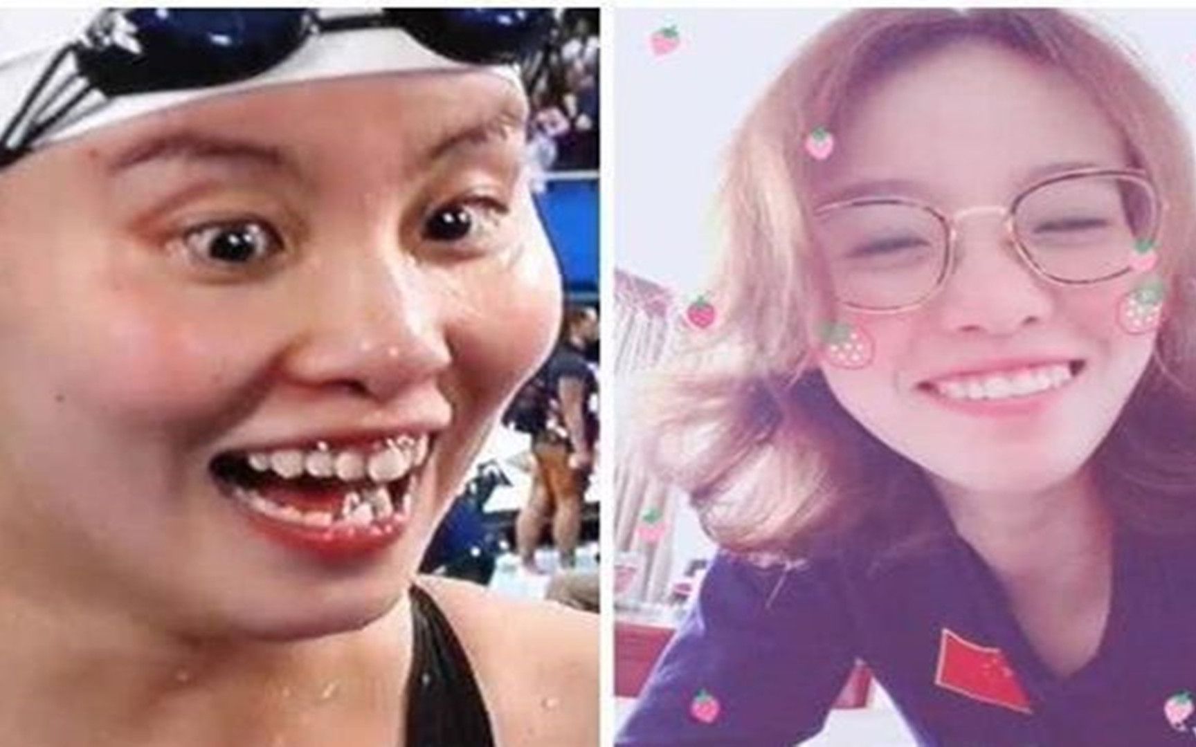 有一种整容叫傅园慧矫正牙齿,简直美绝,终于相信杨幂杨颖没整