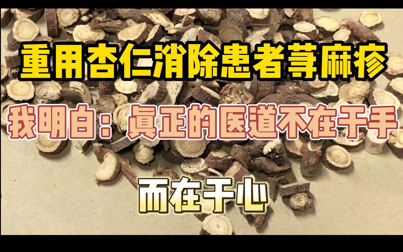 重用杏仁治疗荨麻疹,我明白:真正的医者不在于手,而在于心哔哩哔哩bilibili