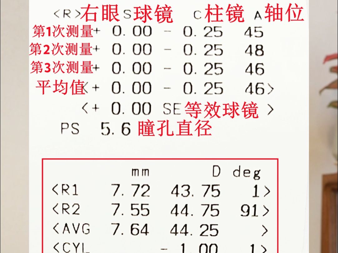 不散瞳验光结果准确吗