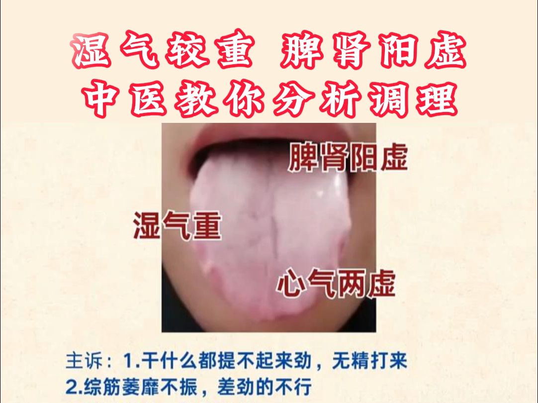 湿气较重,脾肾阳虚,中医教你分析调理