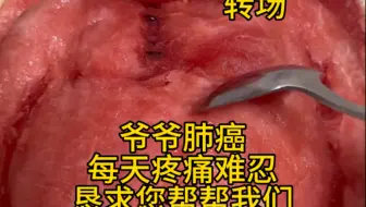 我知道b站不是慈善平台，但爷爷患癌，我真的走投无路了，这里是我最后的希望，恳请你停留一下