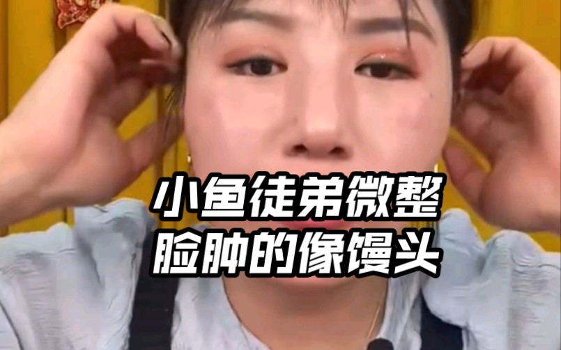 小鱼徒弟微整,脸肿的像馒头哦哔哩哔哩bilibili