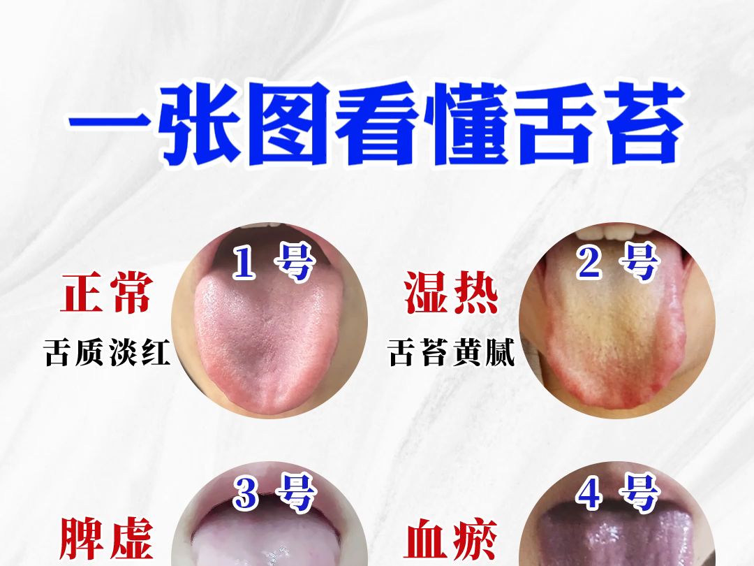 正常舌苔图片部位图片