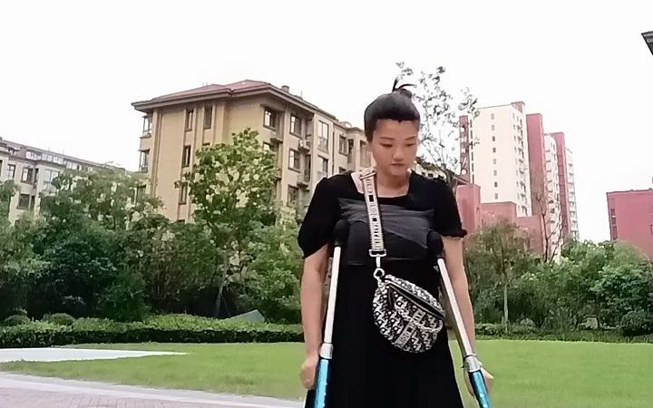 polio, 小儿麻痹症,拄双拐在小区里散步,可爱的残疾女孩(8)哔哩哔哩bilibili