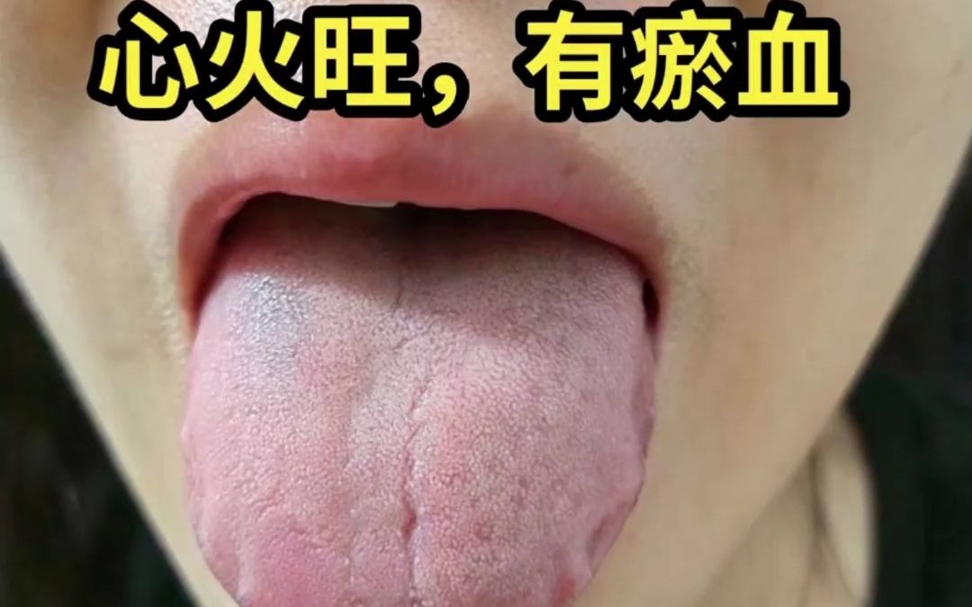 手把手教你看舌诊,慢慢你就学会了哔哩哔哩bilibili