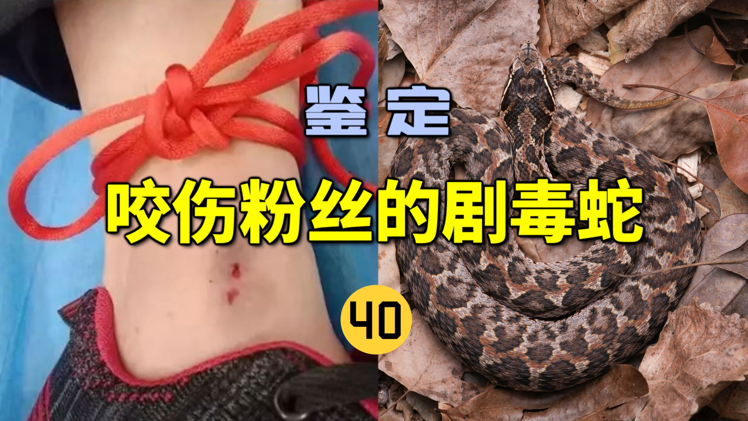 鉴定咬伤粉丝的毒蛇(40)粉丝的弟弟被中国最毒蝮蛇咬伤！竟然屁事儿没有？原来是干咬了！