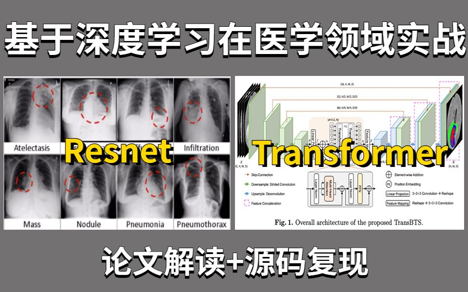 基于深度学习在医学领域实战:Resnet+Transformer!数据集分类实战+医学分割领域拓展应用!论文解读+源码复现,比刷剧还爽!哔哩哔哩bilibili