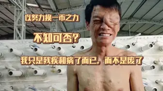 32岁全身肿瘤200立方li米，吃止痛药工作，以努力换取一币之力，不知可否？