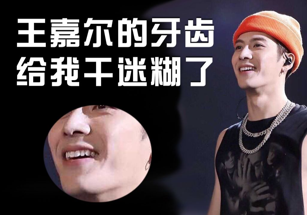王嘉尔的牙齿怎么会这样,我真的是看迷糊了