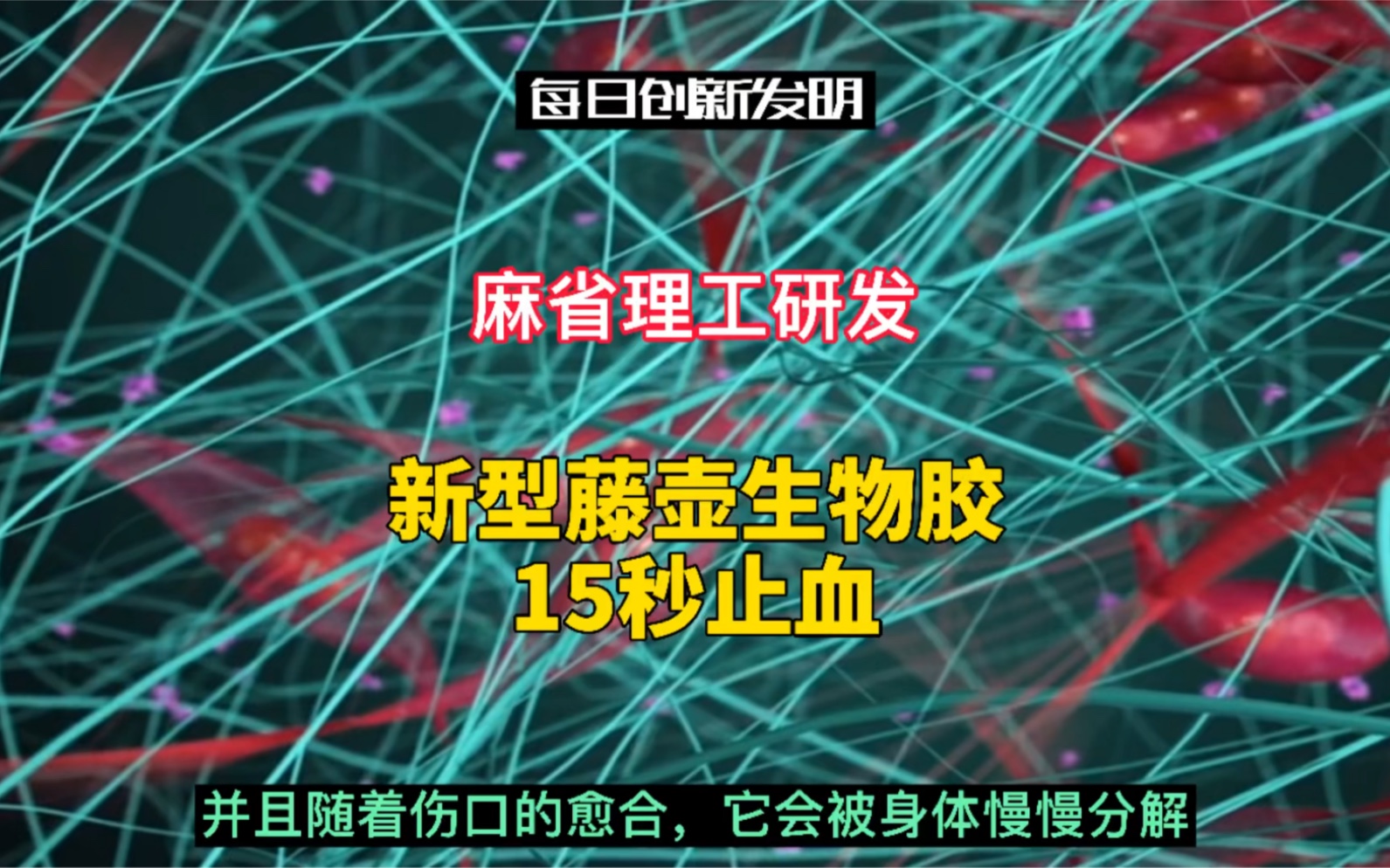 麻省理工研发新型藤壶生物胶15秒止血哔哩哔哩bilibili