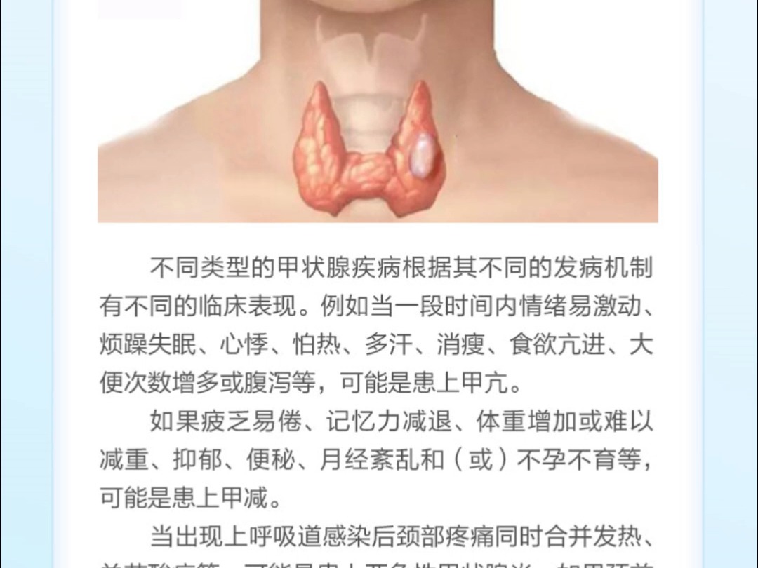 武汉甲康甲状腺研究院张玉生主任甲状腺疾病高发,身体会有哪些隐藏