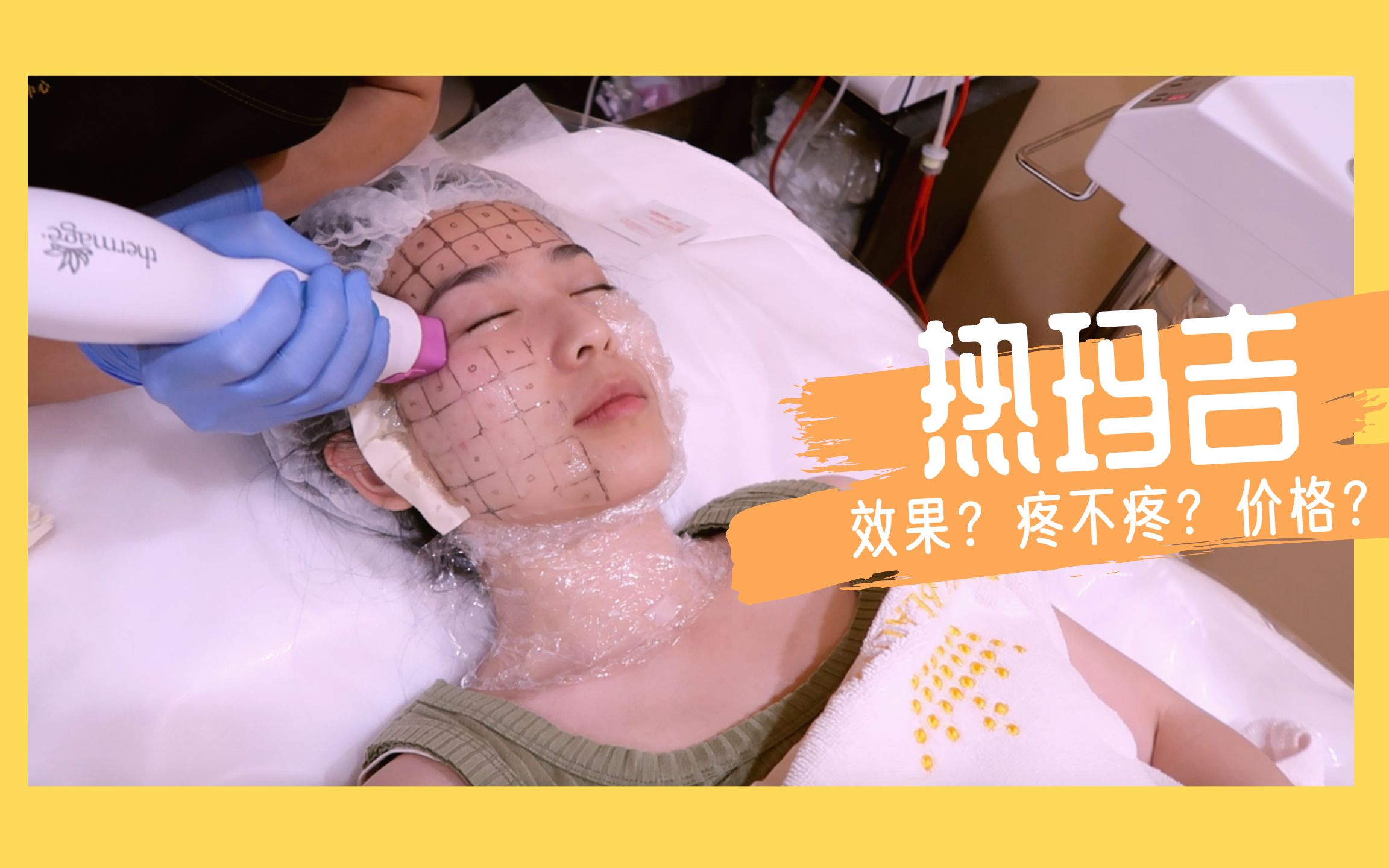 【热玛吉Thermage体验】初期抗老效果 | 改善法令纹?双下巴?变V脸?| 疼不疼 | 如何选择靠谱医美哔哩哔哩bilibili