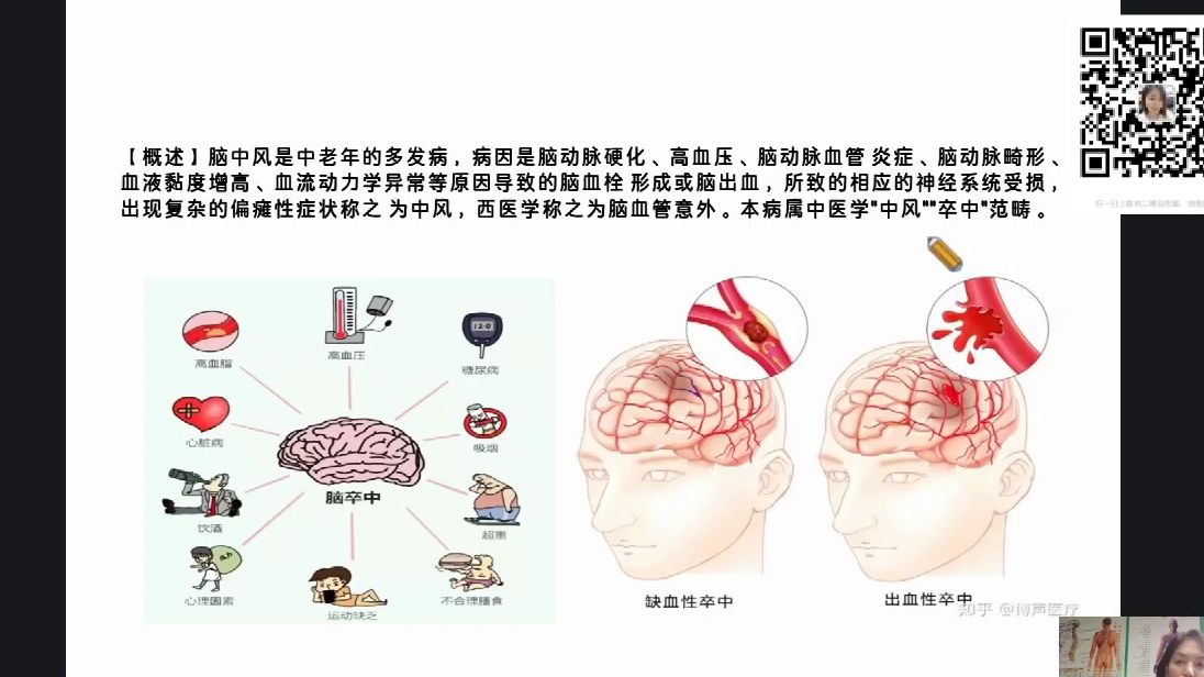 神经节特色埋线治疗常见类疾病(第二晚)——徐海霞哔哩哔哩bilibili