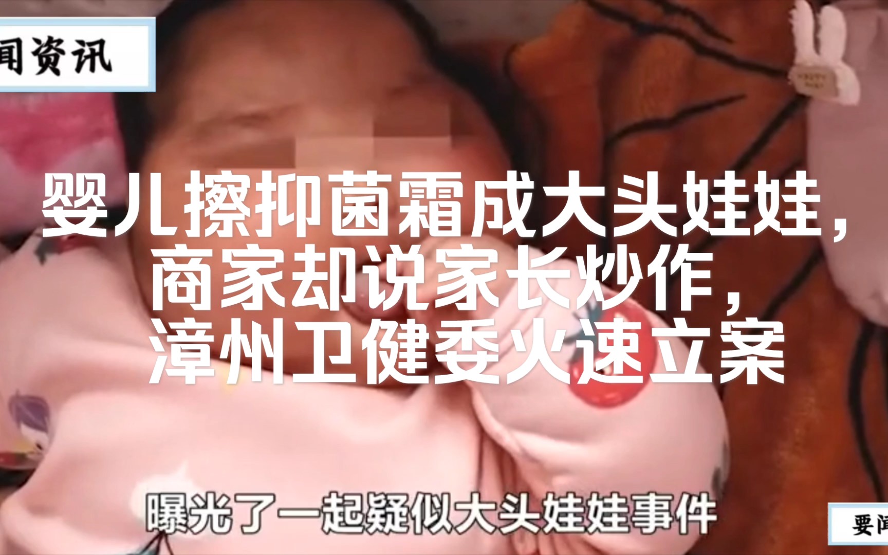 婴儿擦抑菌霜成大头娃娃,商家却说家长炒作,漳州卫健委火速立案哔哩哔哩bilibili