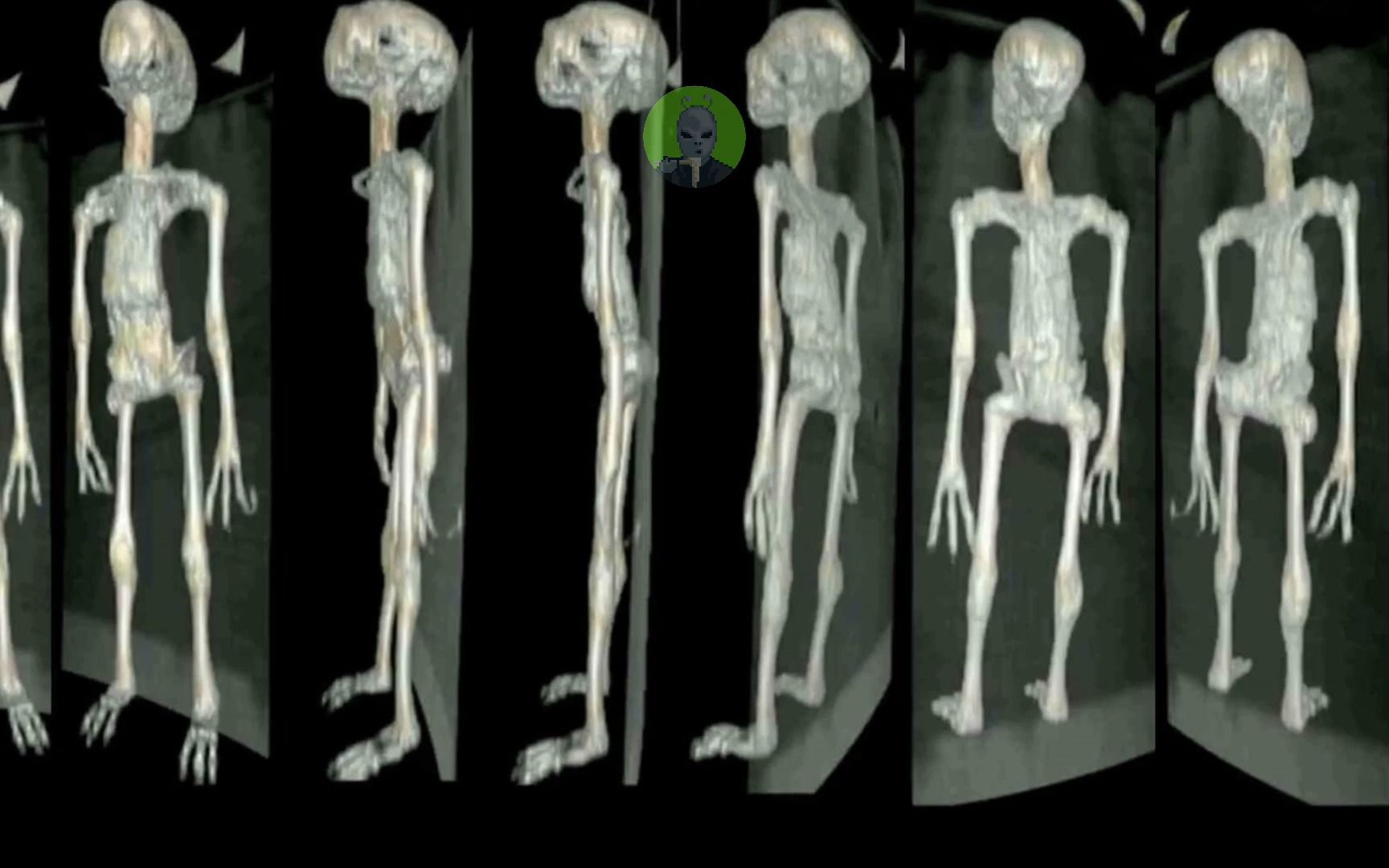 外星人身体剖析内部结构医学影像!