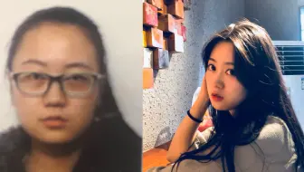 回应质疑：大学四年，我究竟有没有整容