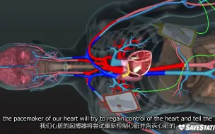 Download Video: 三维视频解释AED除颤仪原理【AED in Action _ A 3D look inside the body】