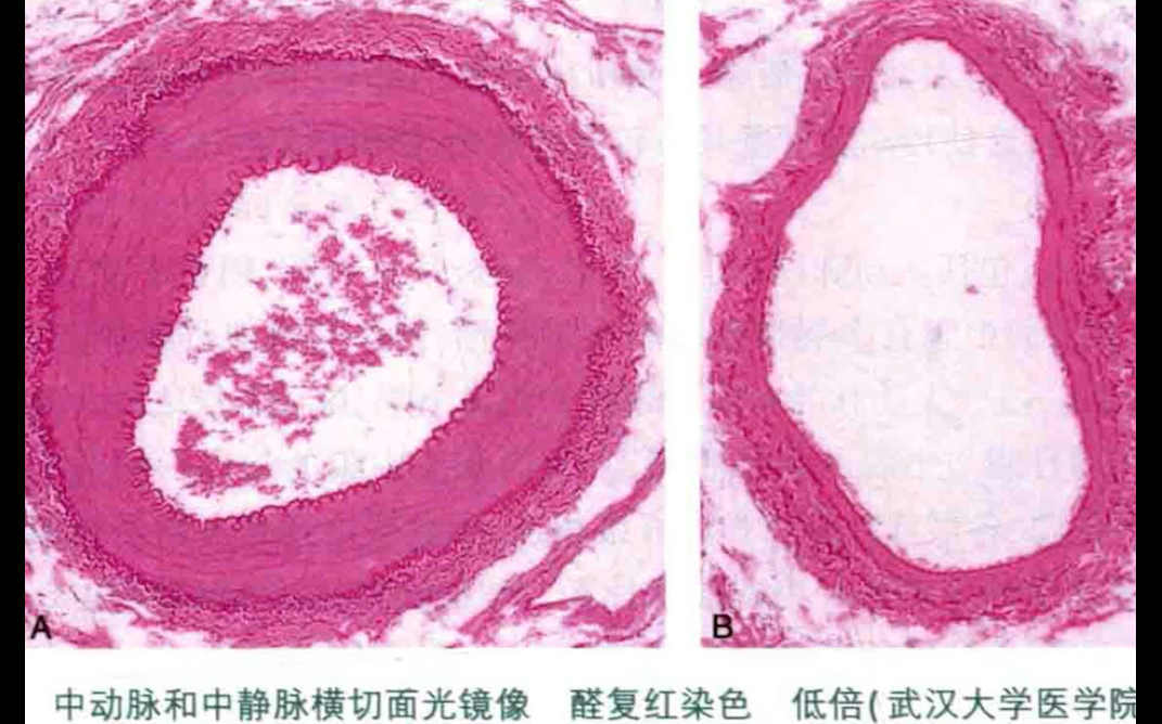 [图]【图解组胚】大中小动脉的玻片识别：都是动脉，咋这么不一样呢