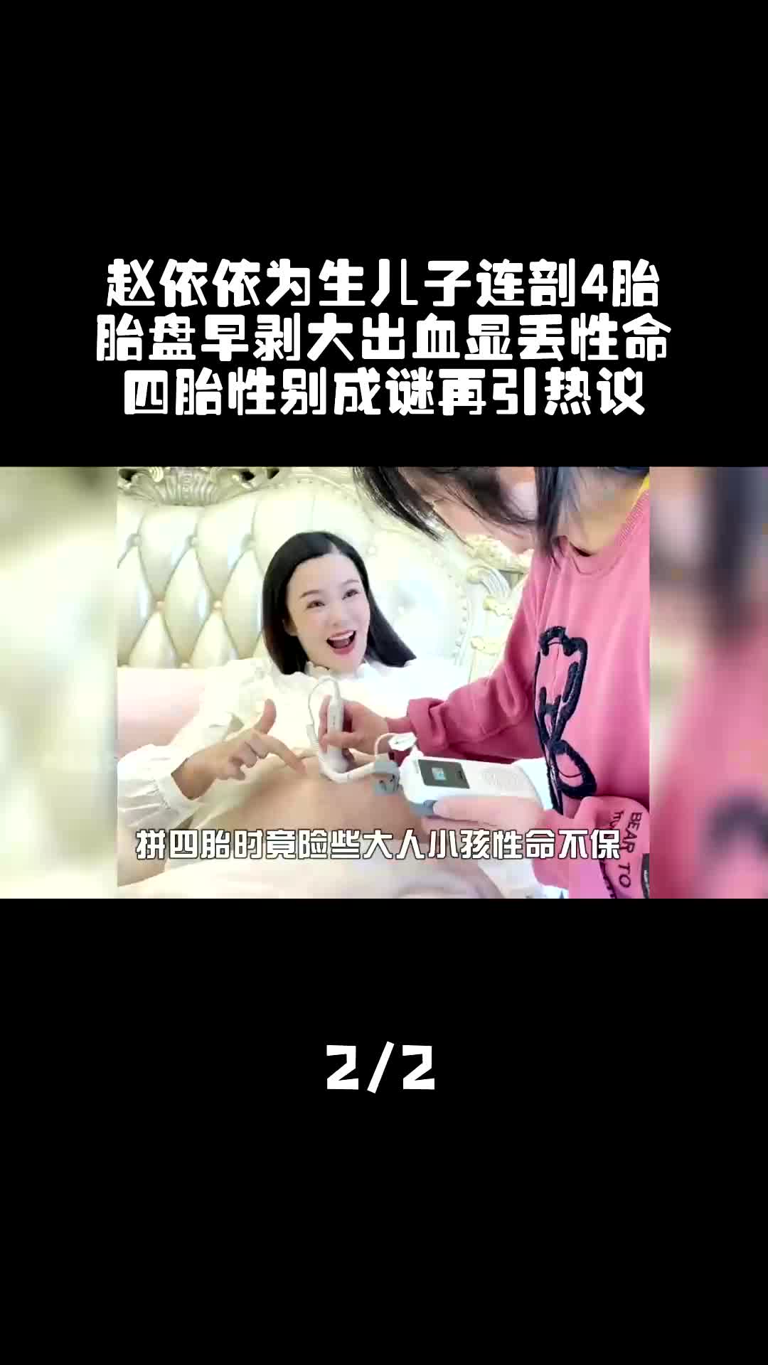 赵依依为生儿子连剖4胎,胎盘早剥大出血显丢性命,四胎性别成谜再引热议哔哩哔哩bilibili