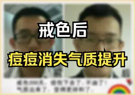 Descargar video: 戒色后，痘痘消失气质提升