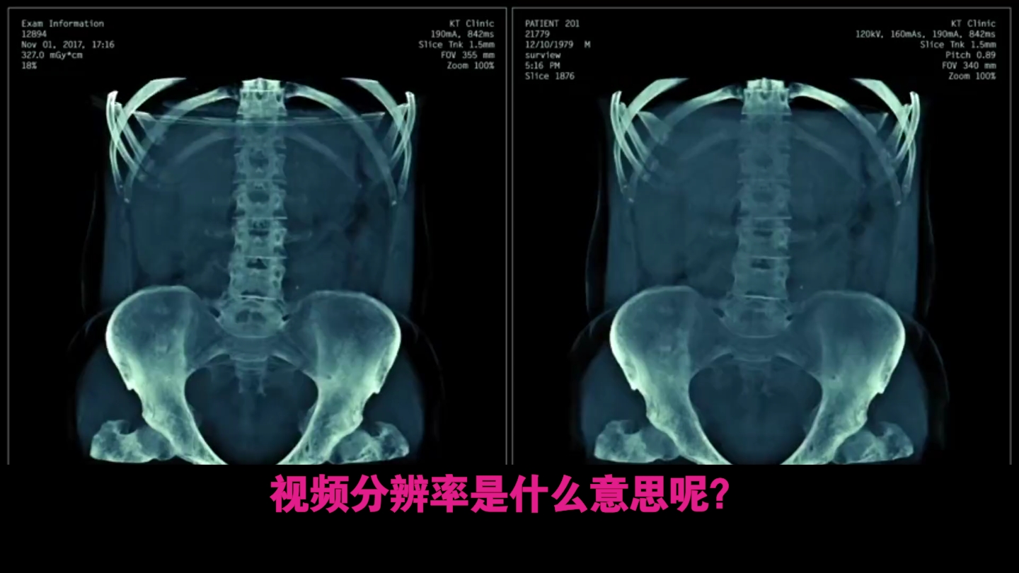 视频分辨率知多少?视频达人早知道哔哩哔哩bilibili