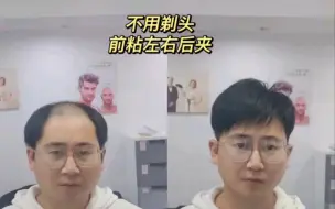 Video herunterladen: 戴假发头的头发不一定要剃掉。