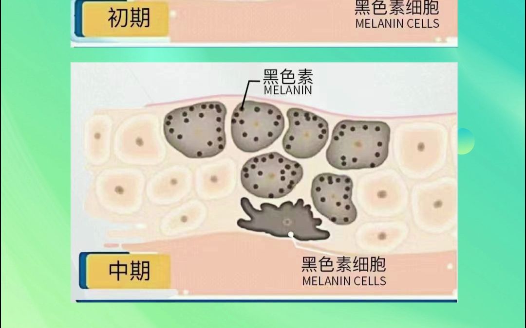 你知道自己的肌肤"表皮"和"底层"黑色素细胞现在处于一个什么阶段吗?