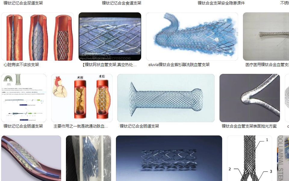 镍钛合金 血管支架ANSYS仿真 Stent, Vessel and Plaque - Walk Through Workshop - part 2