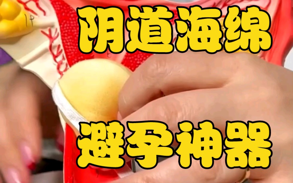 【短发姐】如何用""阴道海绵"防止怀孕?