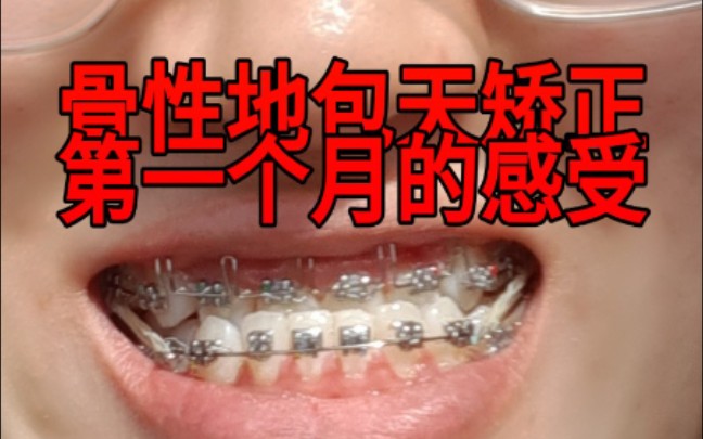 牙套日记骨性地包天矫正第一个月的感受记录
