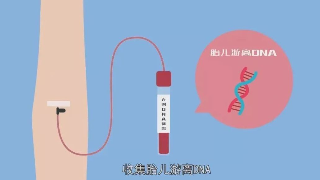 你真的了解无创DNA吗?哔哩哔哩bilibili