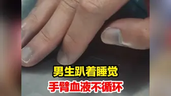 Download Video: 男生趴着睡觉手臂血液不循环，“你的同学有一点点坏掉了耶”，网友:前几秒还不敢笑以为在停尸房