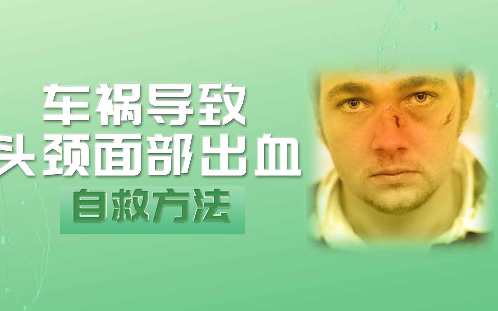 「学自救能互救」车祸导致头颈面部出血,该如何急救?哔哩哔哩bilibili