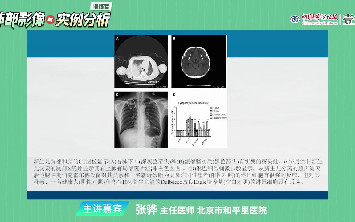 20类鼻疽影像与临床解析哔哩哔哩bilibili