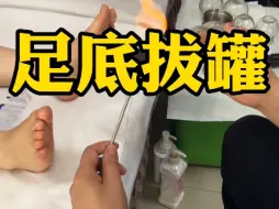 Tải video: 足底拔罐手法教学，可调节多种不适症状～