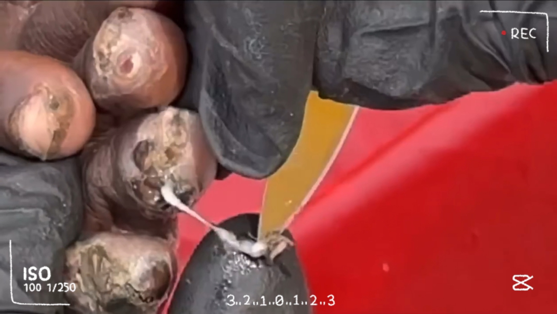 修脚,脚趾上的沙蚤清理