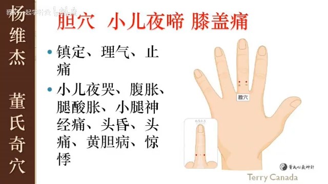 【针灸】胆穴 (董氏奇穴-杨维杰-75)