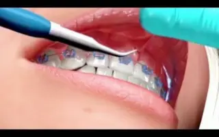 唇系带过长 搜索结果 哔哩哔哩 Bilibili