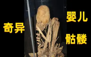 Descargar video: 探秘：博物馆里惊现婴儿骷髅，如此长的头骨，看的人头皮发麻~