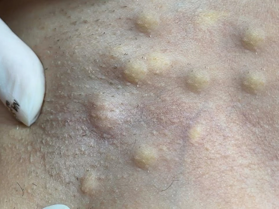 每个脓包各有各的想法