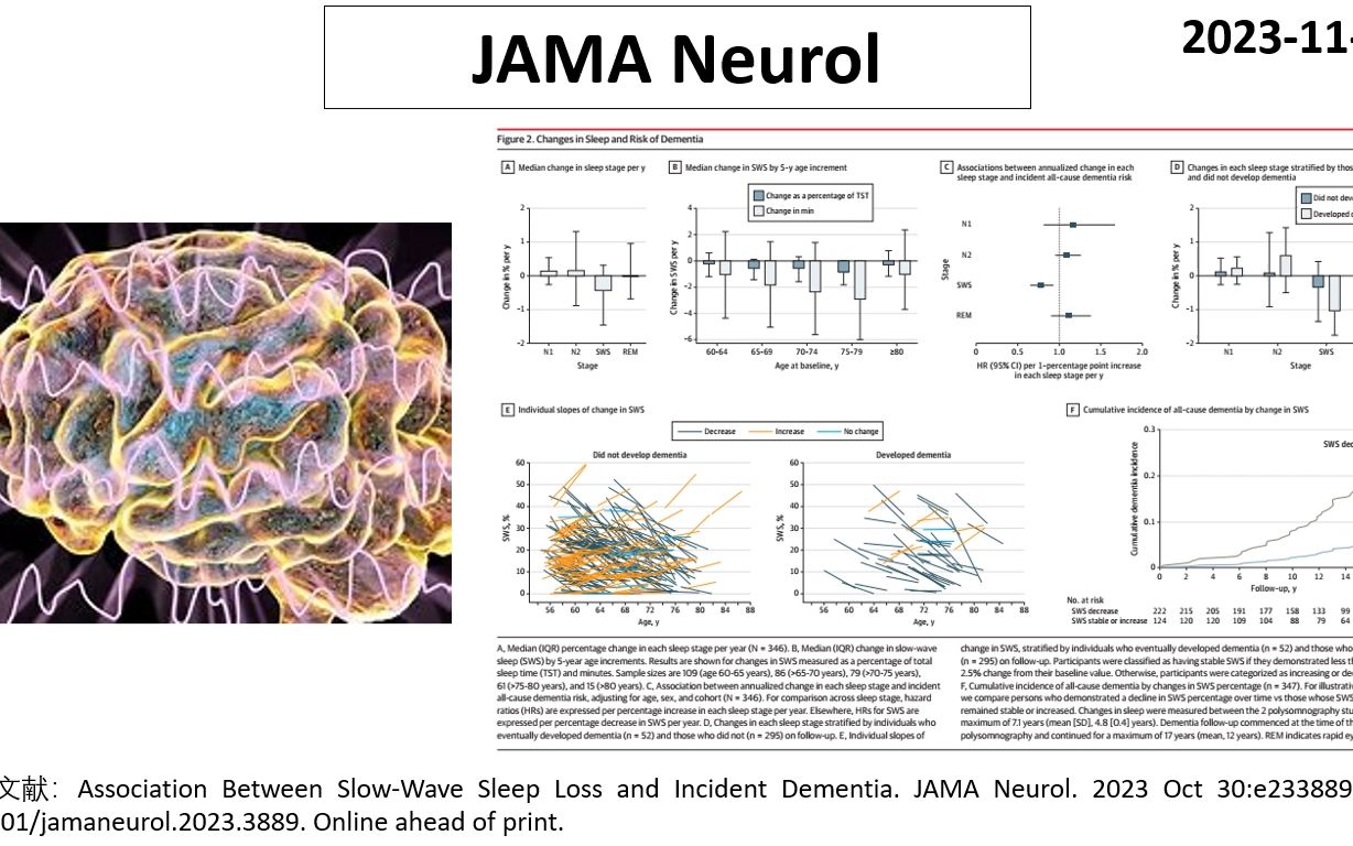 JAMA子刊—慢波睡眠越少,越容易罹患痴呆症哔哩哔哩bilibili