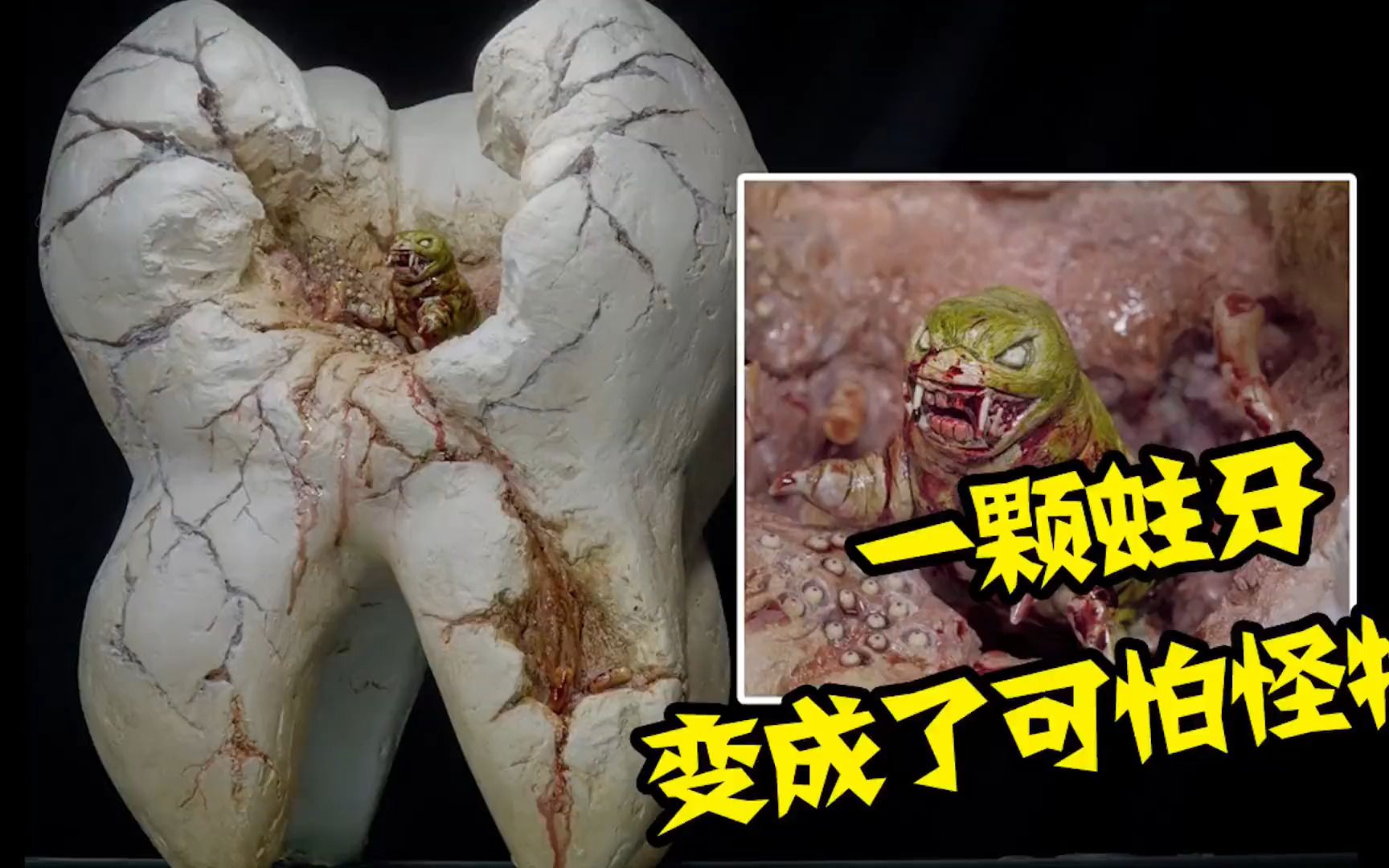模型吃糖不刷牙的后果~蛀牙都变成了怪物.