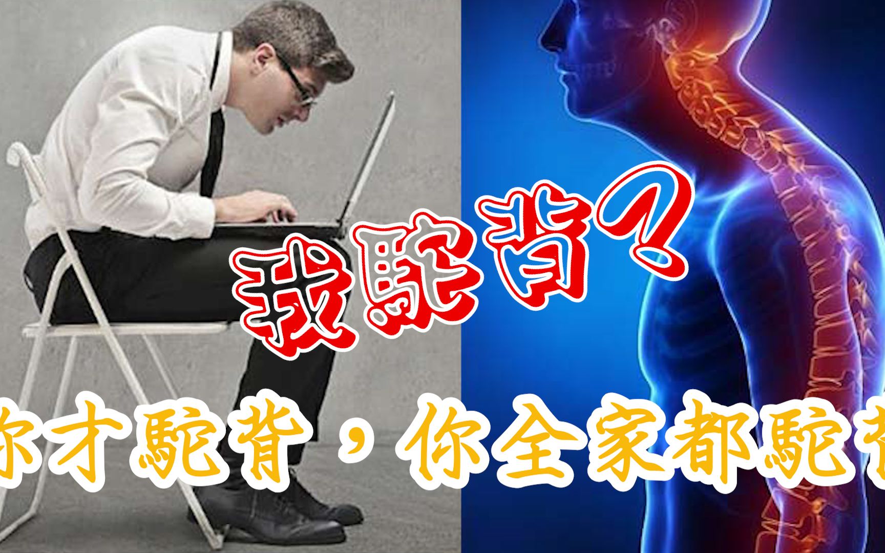 [图]驼背其实有救，不要放弃治疗。