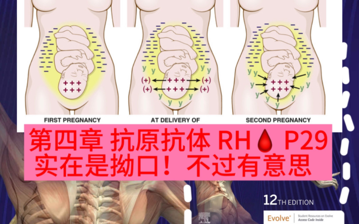 【医学英语】母体RH阴胎儿RH阳 chapter 4: RH condition P29哔哩哔哩bilibili