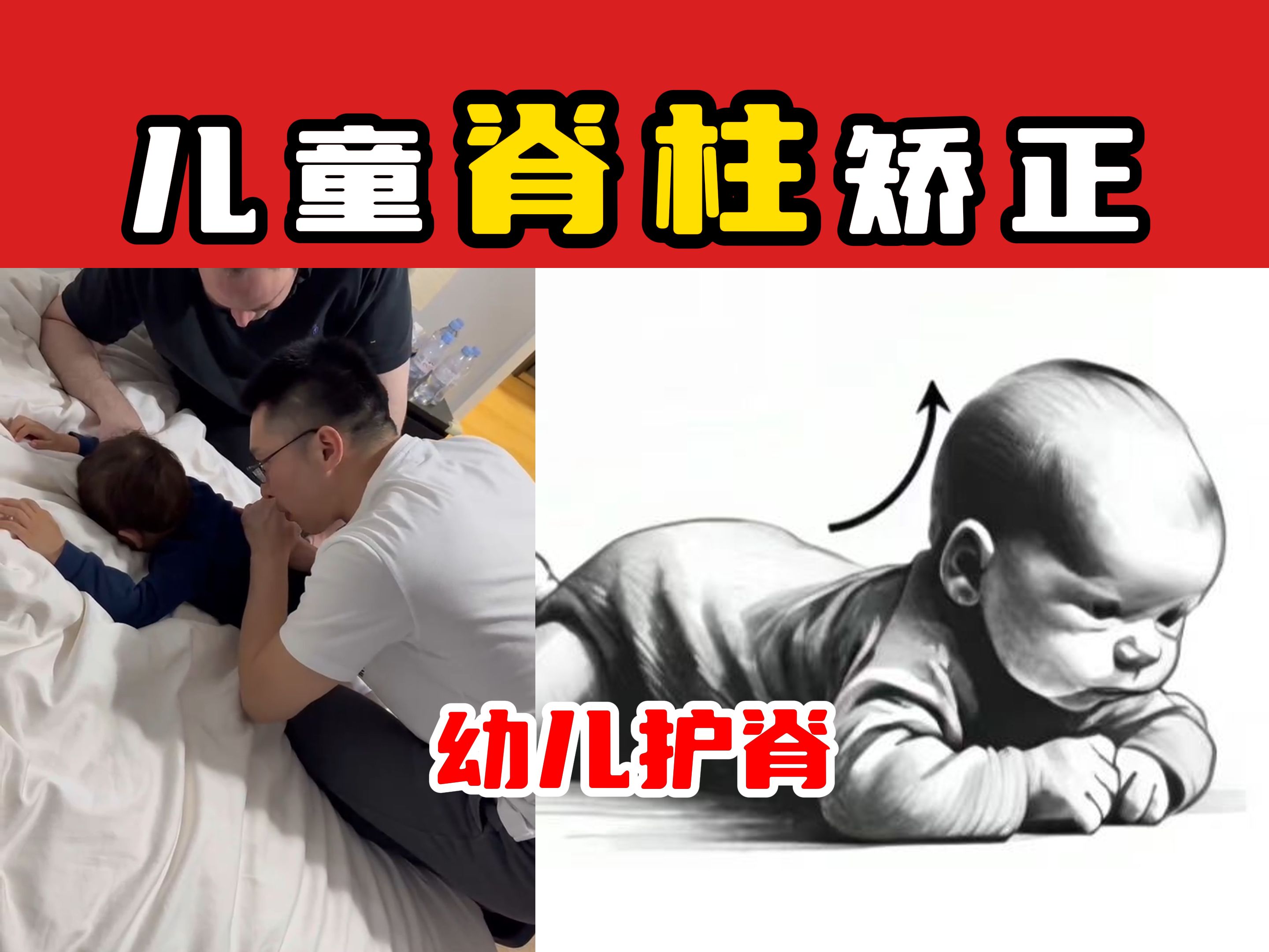 【奥运冠军的脊医博士】儿童脊柱矫正 幼儿护脊哔哩哔哩bilibili