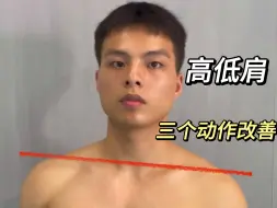 Tải video: 高低肩的根本问题不在肩膀上，而在于整个身体的不对称性。