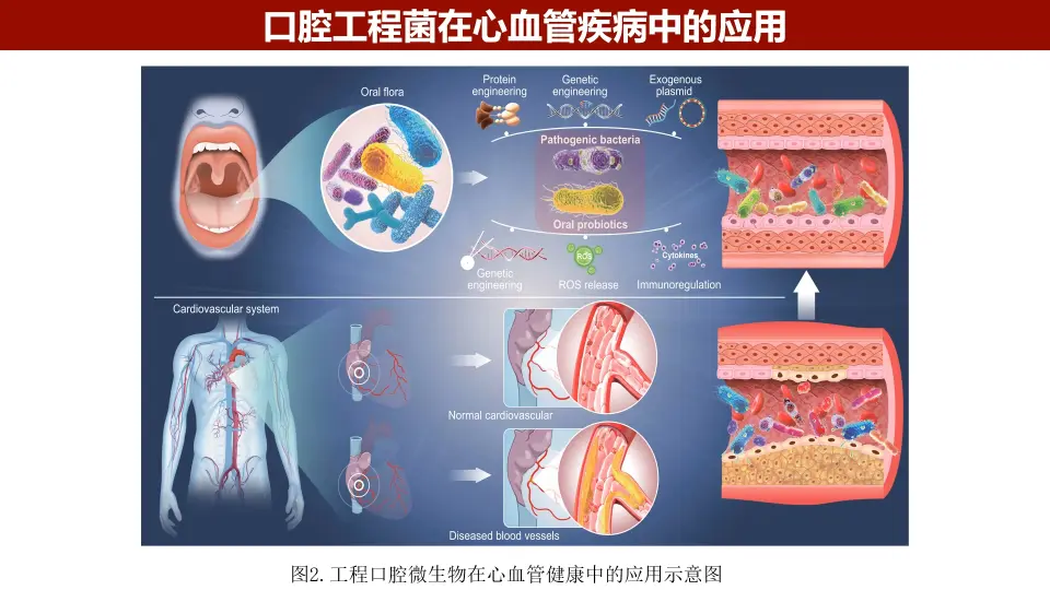 iMeta | 安徽医科大学张亨国组-口腔微生物工程化在心血管疾病治疗中的 