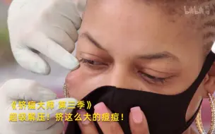 下载视频: 【挤痘大师 第三季】看点2：超级解压！挤这么大的痘痘！竖版