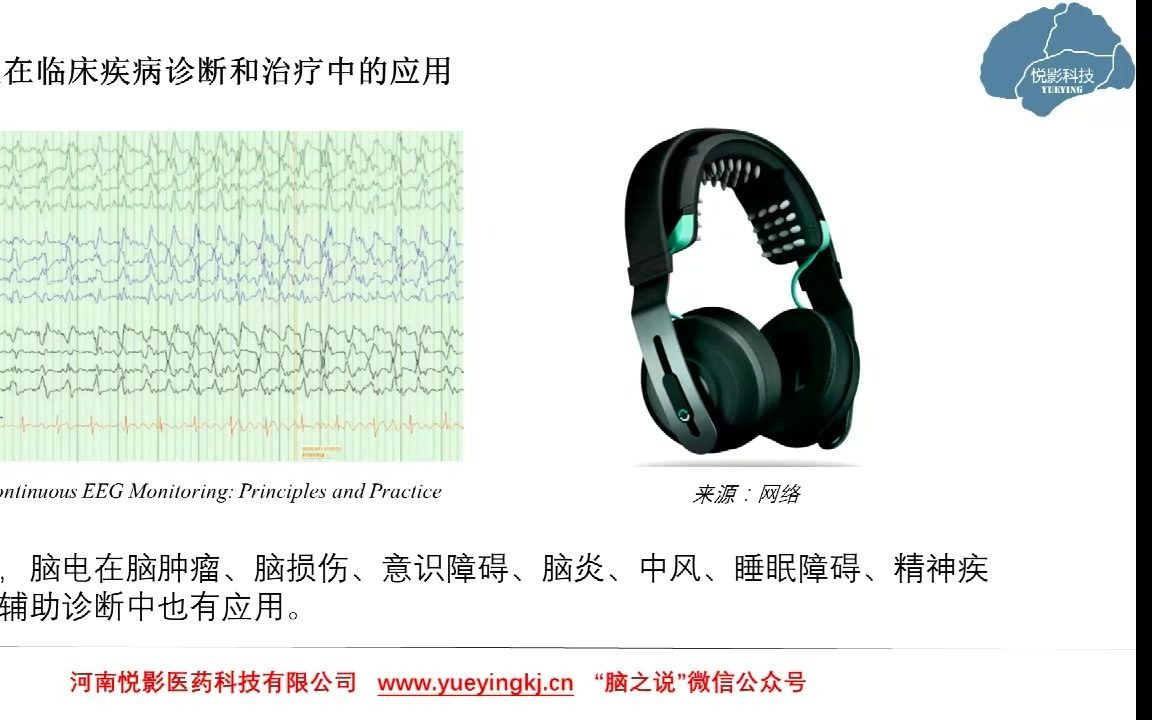 悦影科技EEG/ERP基础知识系列讲座第14讲:脑电在临床和科研中的应用概述哔哩哔哩bilibili